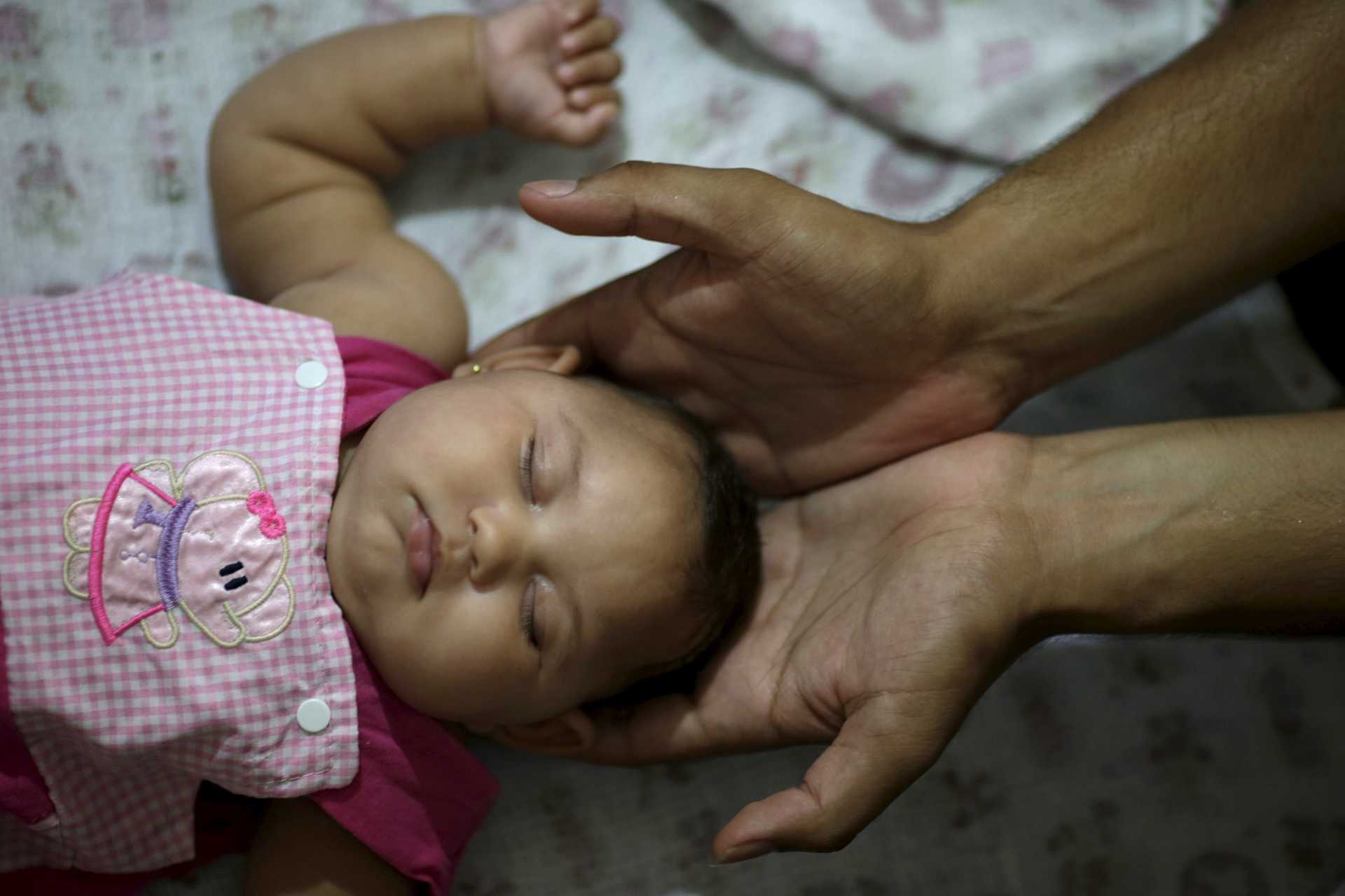 Felipe holds the head of his daughter Maria Geovana, who has microcephaly, at his house in Recife