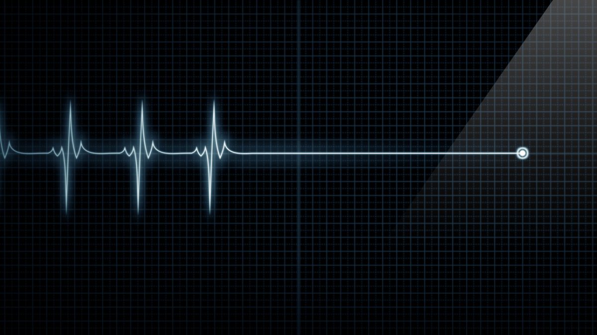 Heart Monitor Flat Line Death