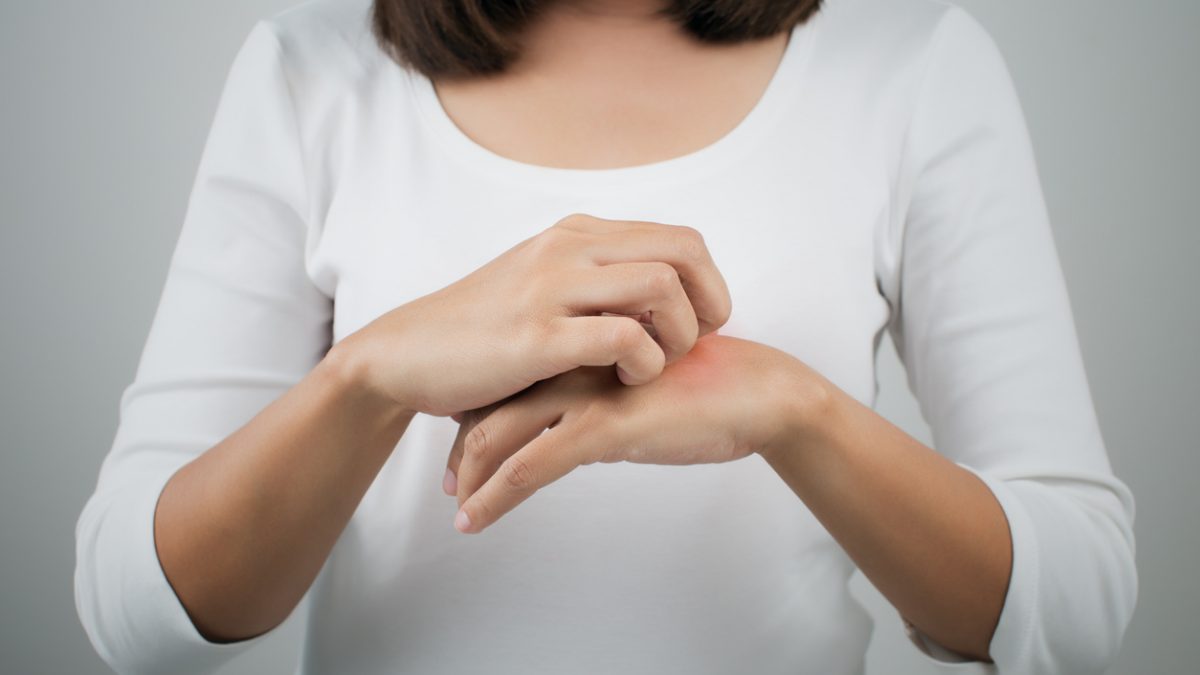 A woman itching the back of her hand