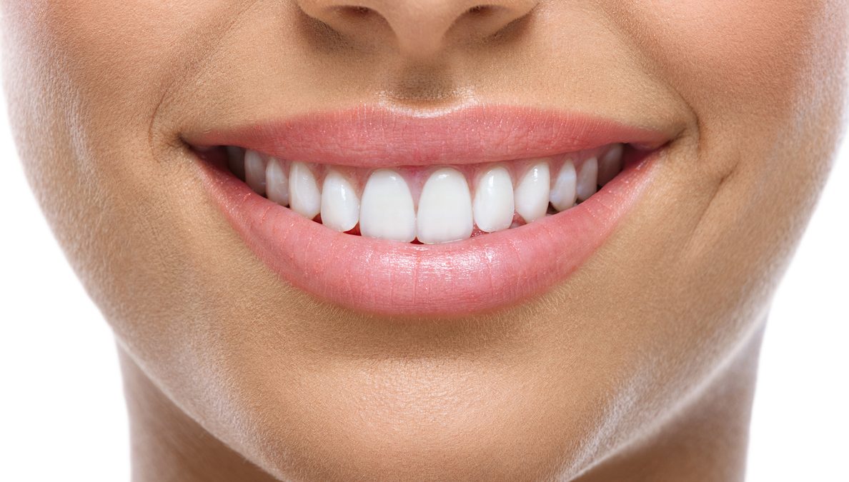 closeup of smile with white teeth