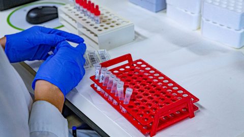 Teste cancro urina ciência