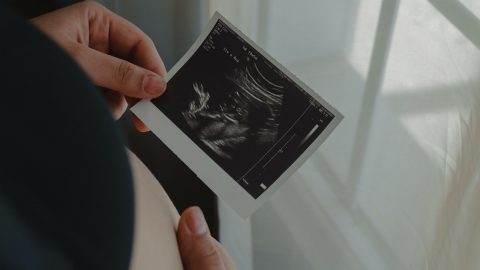 aborto IVG mulheres